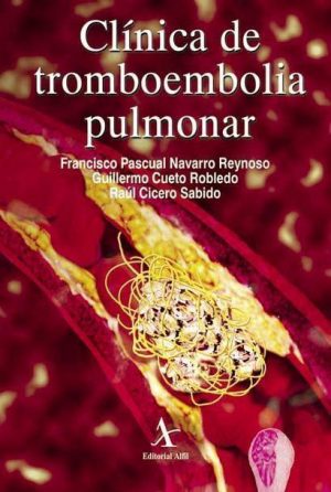 Clínica de tromboembolia pulmonar
