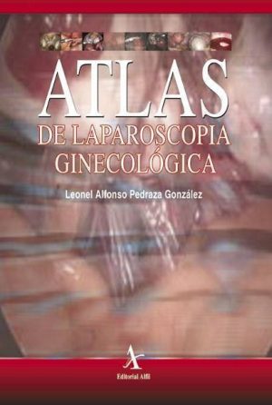 Atlas de laparoscopia ginecológica